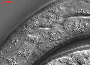 Microscopic image of roundworm intestine infected with microsporidia spores