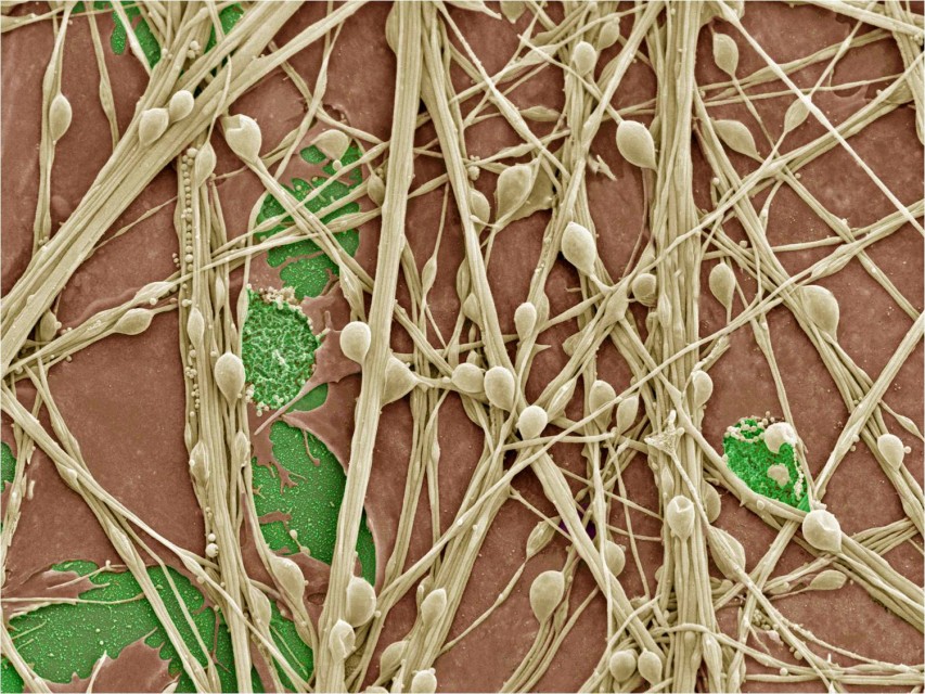 human neurons and synapses