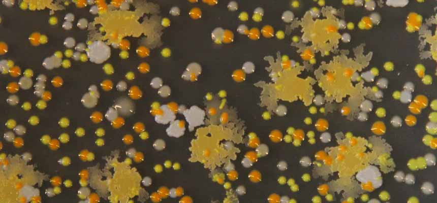 microscopic image of cheese colonies