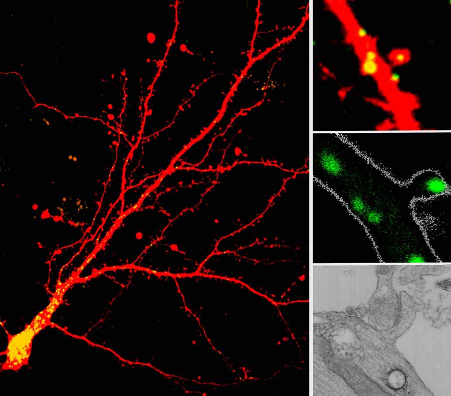 a series of microscopic images of cell dendrites with lysosomes visibly marked