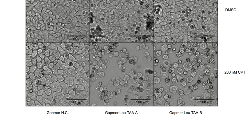 Microscopic screenshot of pancreatic cells re-sensitized to chemotherapeutic treatment