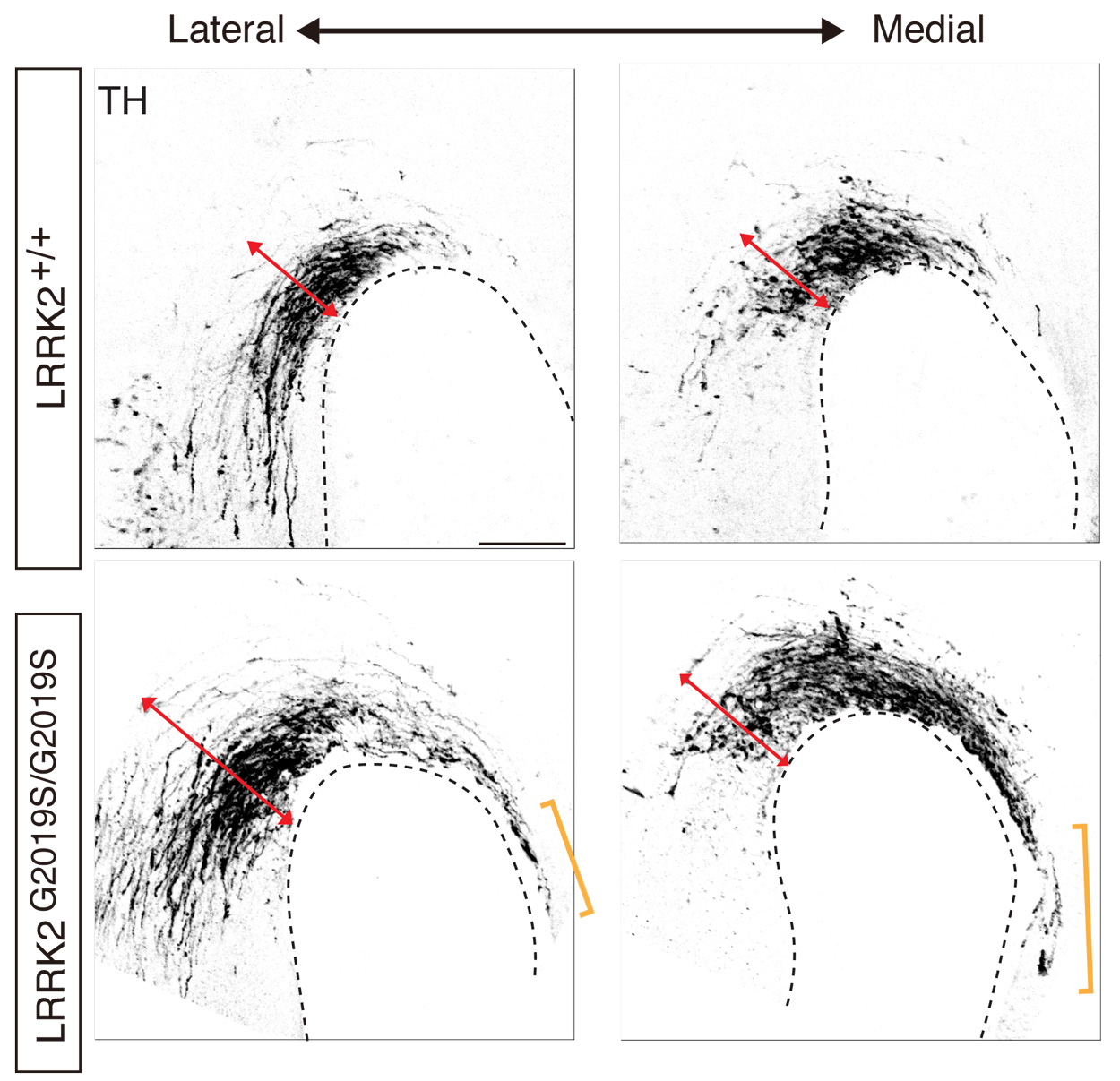 A series of neuronal images show abnormal development of midbrain dopaminergic axons.