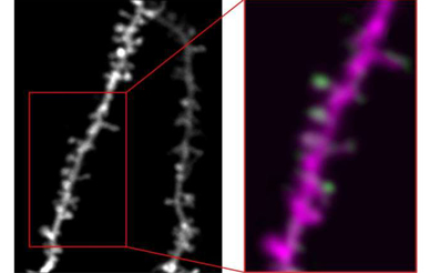 The left image shows a dendrite like the ones we imaged in our study, studded in dendritic spines (the mushroom-like structures). The right image shows a portion the same dendrite (indicated by a red box), colored in magenta, overlaid with synaptic activity signals (green). I’m zooming in on a few spines that were co-active together; these are the “clusters” that we describe in our study.