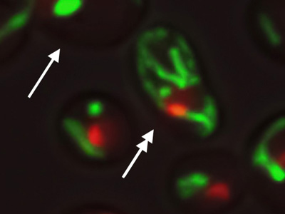 Microscopic image of mitochondric and nucleolus cells
