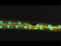 the transparent roundworm Caenorhabditis elegans