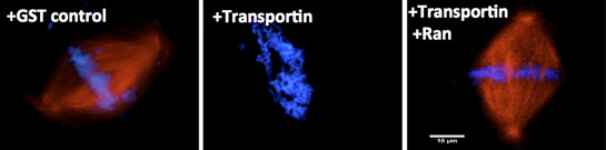 Microscopic photo of +GST control, +Transportin, +Transportin and Ran