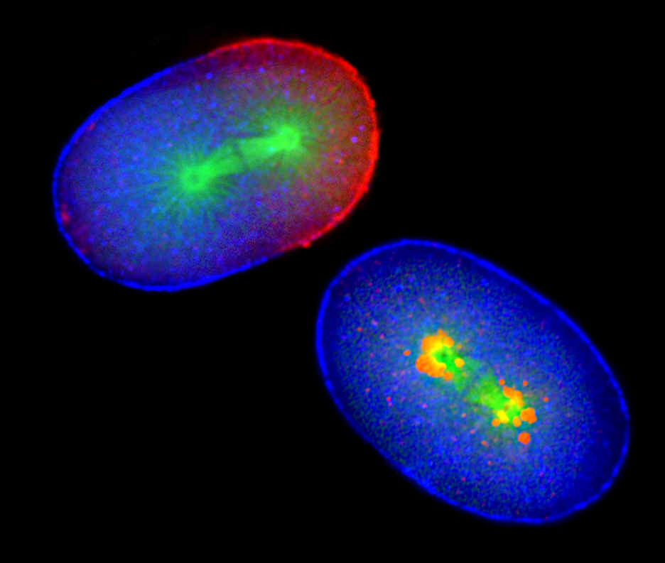 Microsopic image of normal embryo (left) and APC-impared embryo (right)