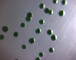 Photo of colonies of cyanobacteria floating in water