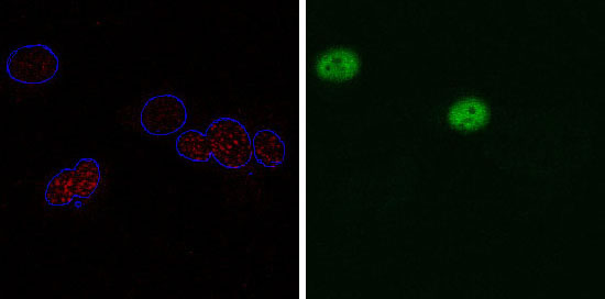 Photos showing p53 mutant protein (green, at right) inhibiting the activation of cell's DNA repair mechanism (red, at left). Credit: Hoseok Song, UCSD