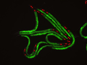 Green fluorescent proteins signify the expression of immune genes in the roundworm’s intestine. 