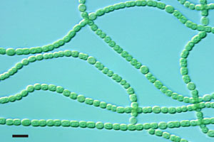 Photo of cyanobacteria chains, like a string of green pearls