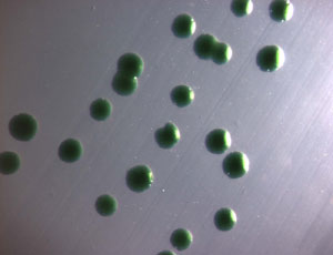 Photo of individual cyanobacteria, which look a lot like peas