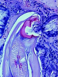 Adult hookworm attached to intestine.<br>Credit: Richard Bungiro, Yale