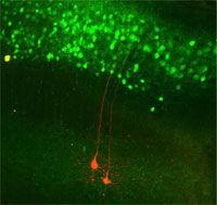 Immunofluorescence photo of neurons, described in article