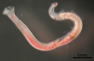 Hookworm