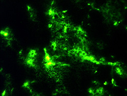 Microscopic image of blood marked with fluorescent dye spills from a tumor's leaky vessels.