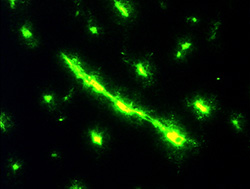 Micropic image of blood vessels in green