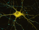 Microscopic image of brain cells
