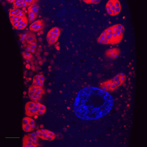 Colored microscopic image of roundworm intestine stained to reveal microsporidia cytoplasm in red and their DNA in blue.