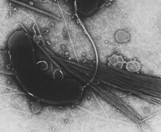 The scientists used a protein produced by the bacterium responsible for cholera, Vibrio cholera, that binds to intestinal epithelial cells.