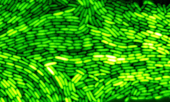 Florescent green E. coli bacteria