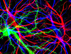 Hippocampal cells with neuron in green