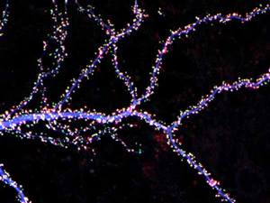 Hippocampal neuron from rodent brain with dendrites shown in blue.