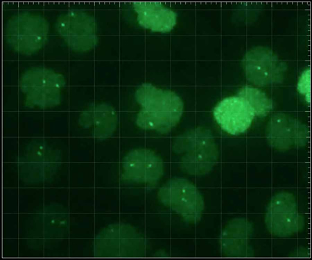 marked cells