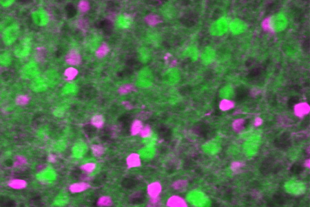 E/I Neurons