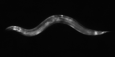 xray of a worm
