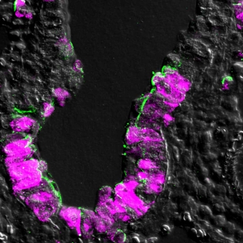 Mouse lung cells infected with influenza marked by expression of NS1 in magenta.