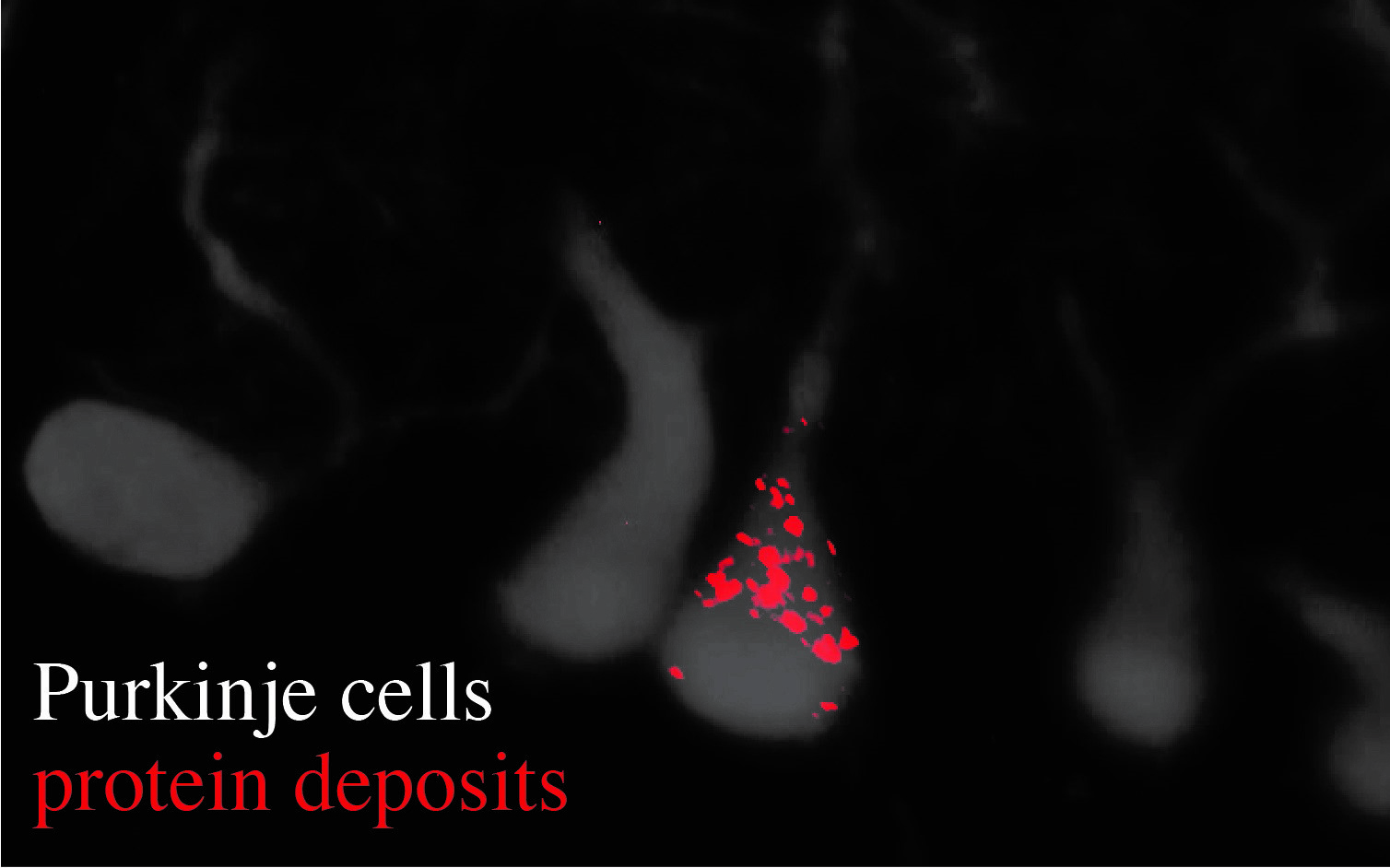 Gray Purkinje cells with red protein deposits