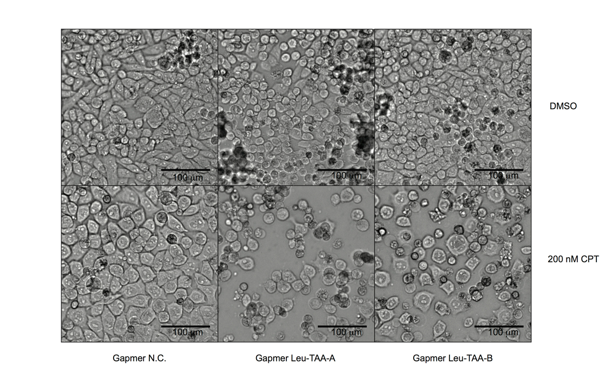 Microscopic screenshot of pancreatic cells re-sensitized to chemotherapeutic treatment