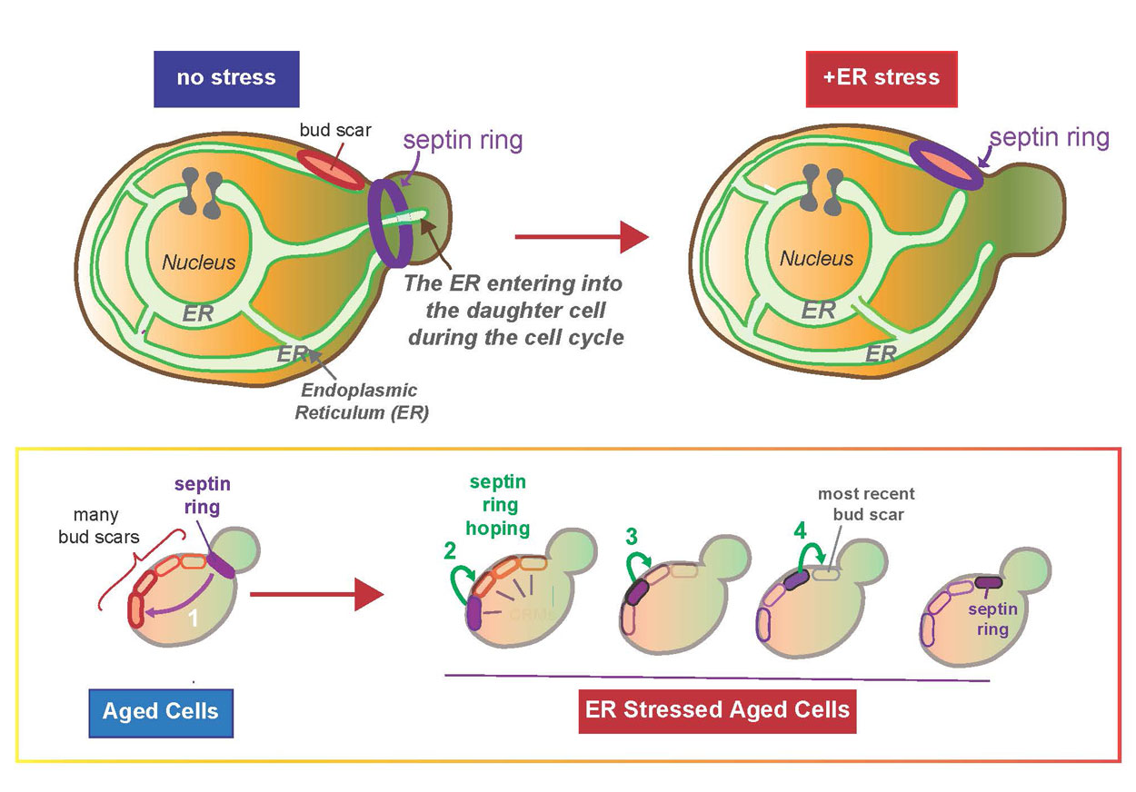 A figure depicting how the location of the septin ring changes when there is Endoplasmic Reticulum (ER) stress in a cell