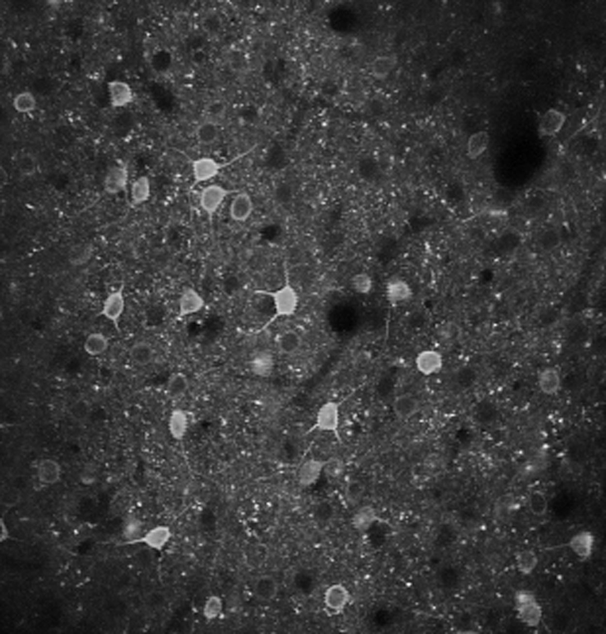 Microscopic greyscale image of neurons