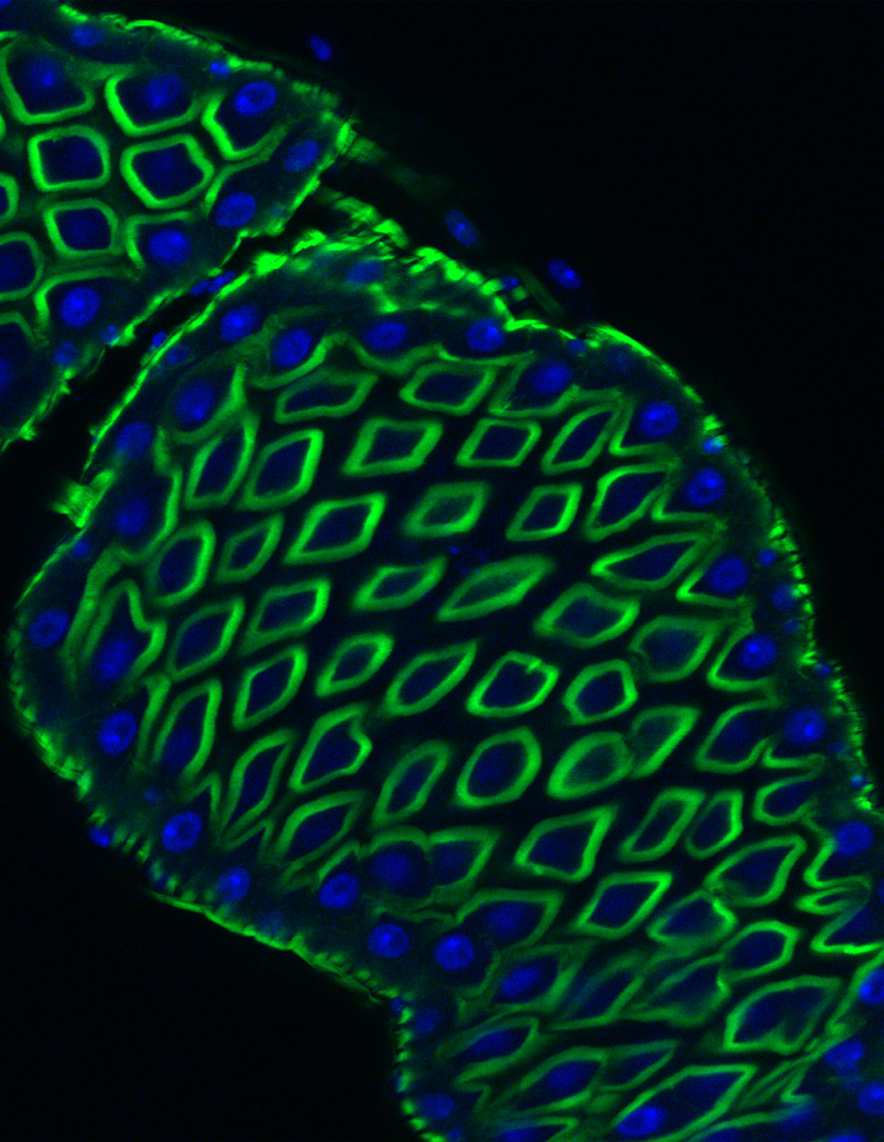 A microscopic photo of blue-green blob representing a fruit fly gut on a black background