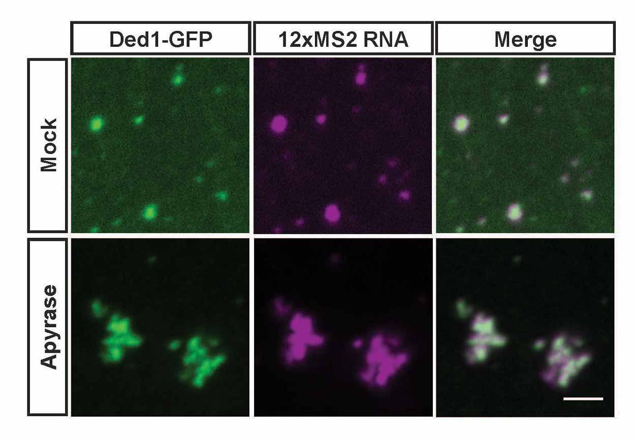 A series of images of stress granules forming fibers similar to those seen in neurodegenerative conditions.