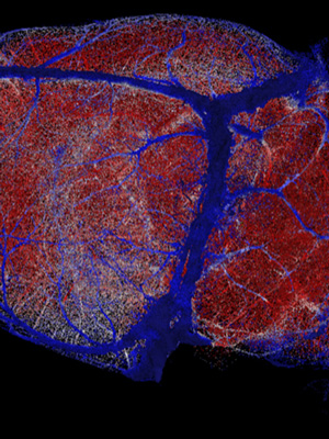 brain map certain regions are represented by red, white, and blue