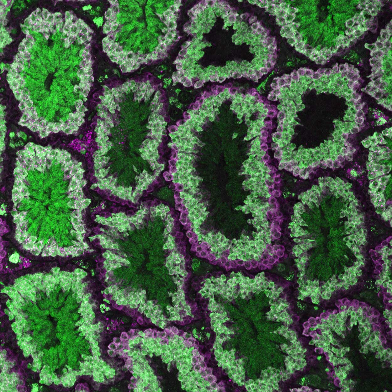 Spermatocytes and germ cells color coded