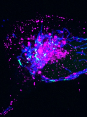 Endosomes collect around mitochondria after infection