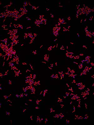 A fluorescence microscopy image reveals the tuberculosis-causing bacterium Mycobacterium tuberculosis after an antimicrobial treatment. 