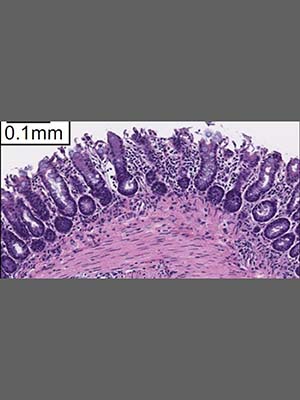 Colon histology in mice with pDCs.