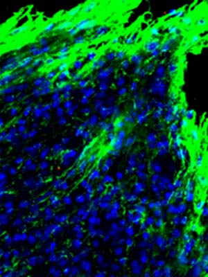 Astrocyte branches at an injury site.