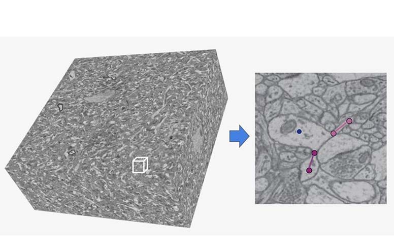 High-resolution 3D electron microscopy of reconstructed brain tissue.