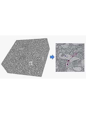 High-resolution 3D electron microscopy of reconstructed brain tissue.
