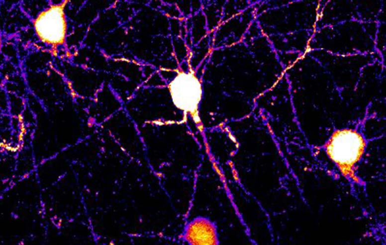 Neurons and dendrites