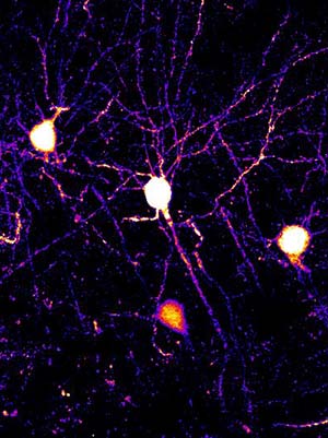 Neurons and dendrites