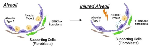 diagram of alveoli vs injured alveoli shows behavior of p16INK4a+