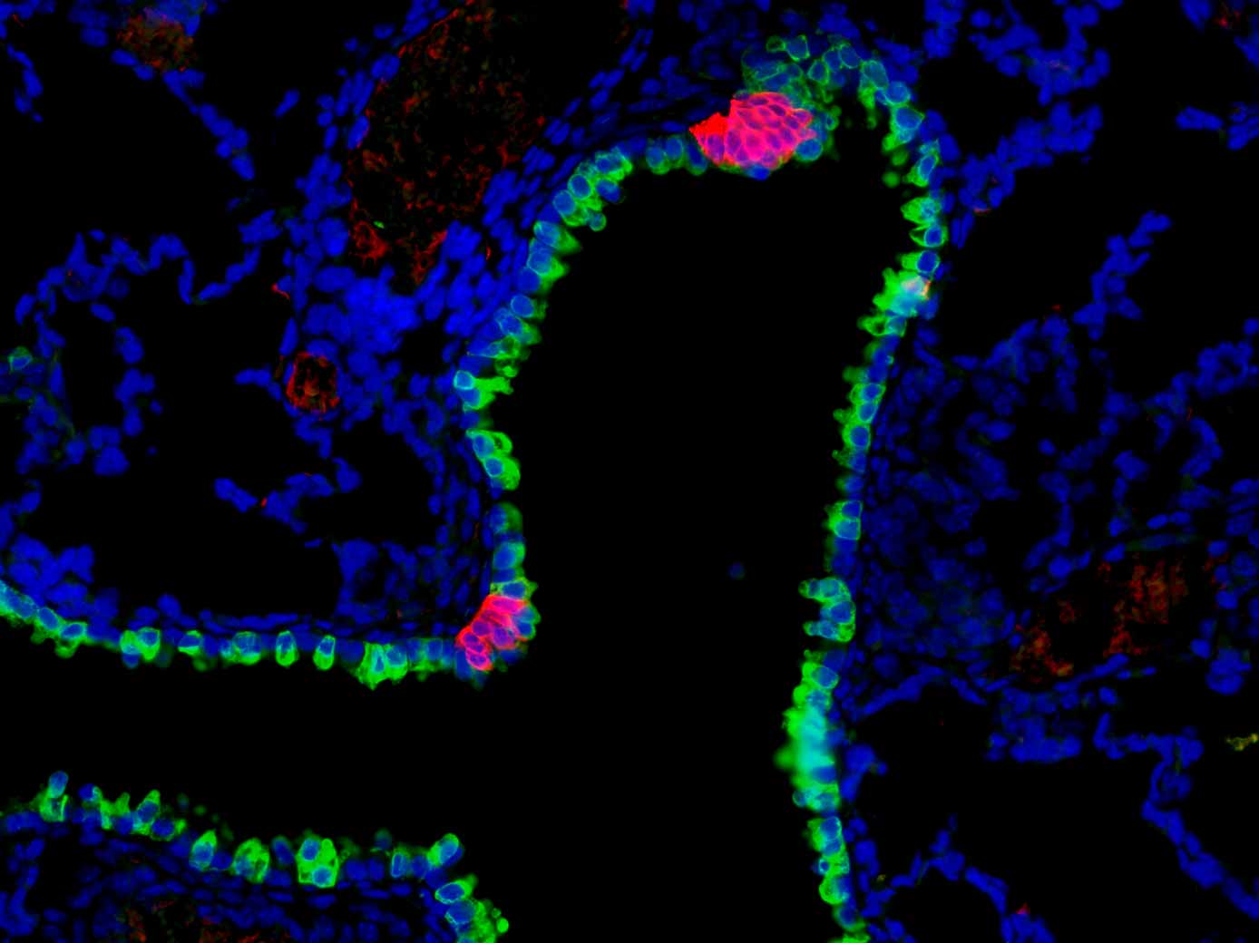 A mouse airway outlined by an epithelial marker for club cells (green), annotated by clusters of pulmonary neuroendocrine cells (magenta) which perform sensory function